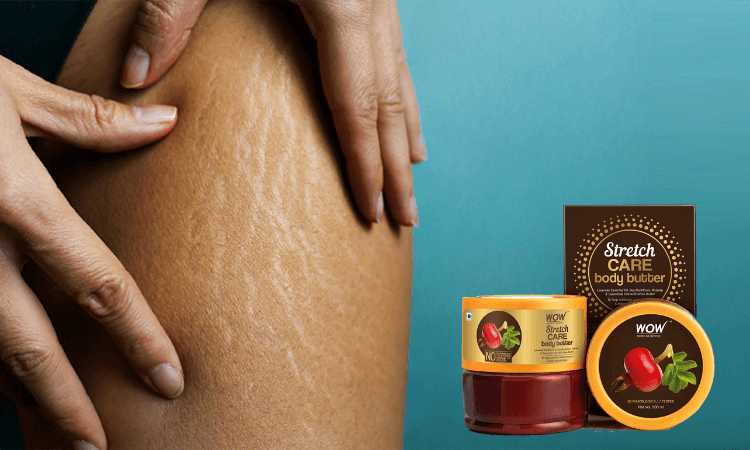 Best-Stretch-Marks-Removal-Cream-In-India